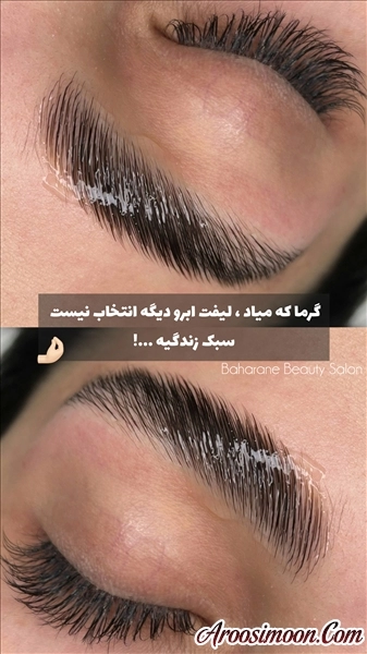 لیفت ابرو سالن بهارانه