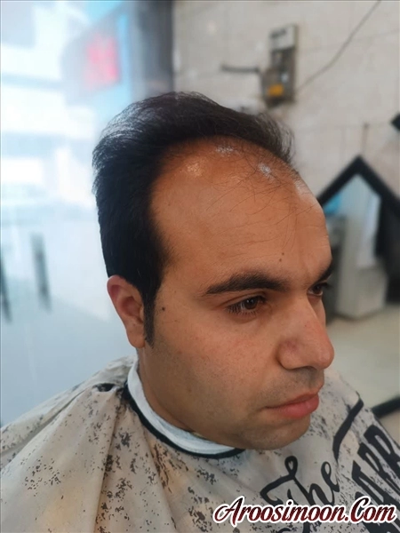 پیرایش آلفا اصفهان