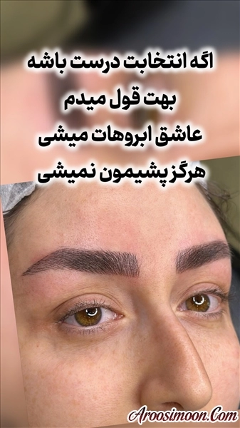 بهترین فیبروز ارتیست بیرجند