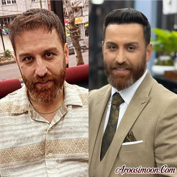 پیرایش پایون ساوه