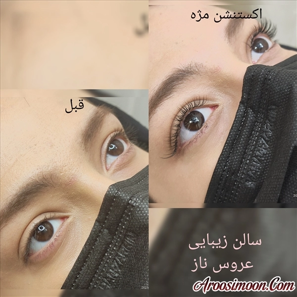 اکستنشن کلاسیک 