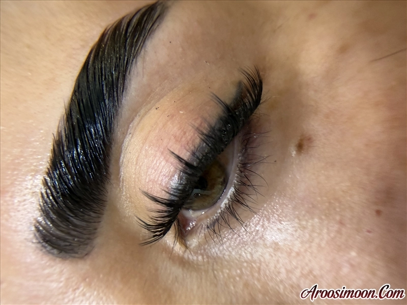 کاشت موقت و لیفت ابرو 